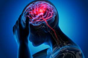 Stroke affecting a person's brain concept